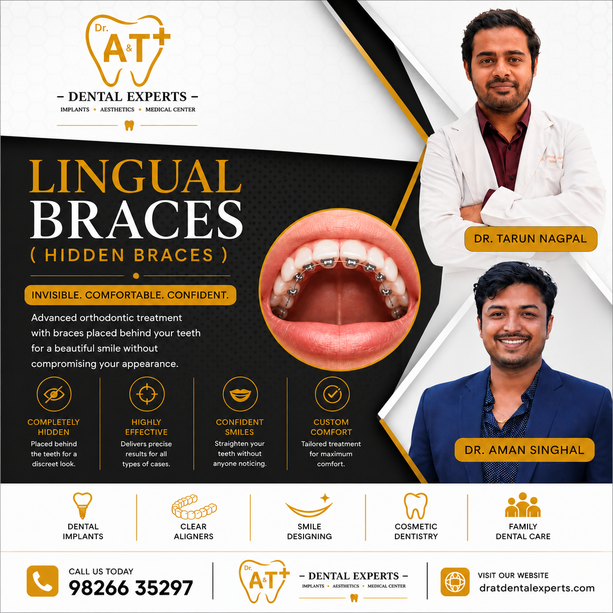 Teeth Braces In gwalior