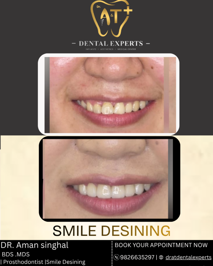 smile Designing Clinic In gwalior