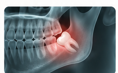 mouth pain in wisdom tooth